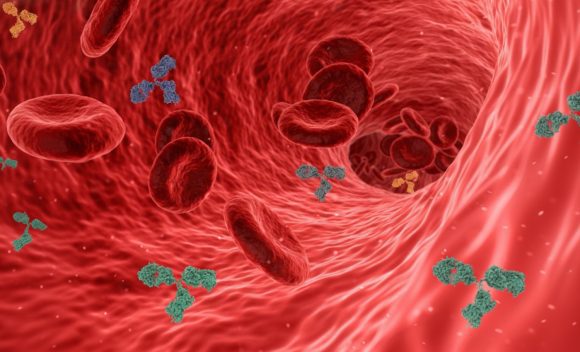 IHHT bei Arteriosklerose